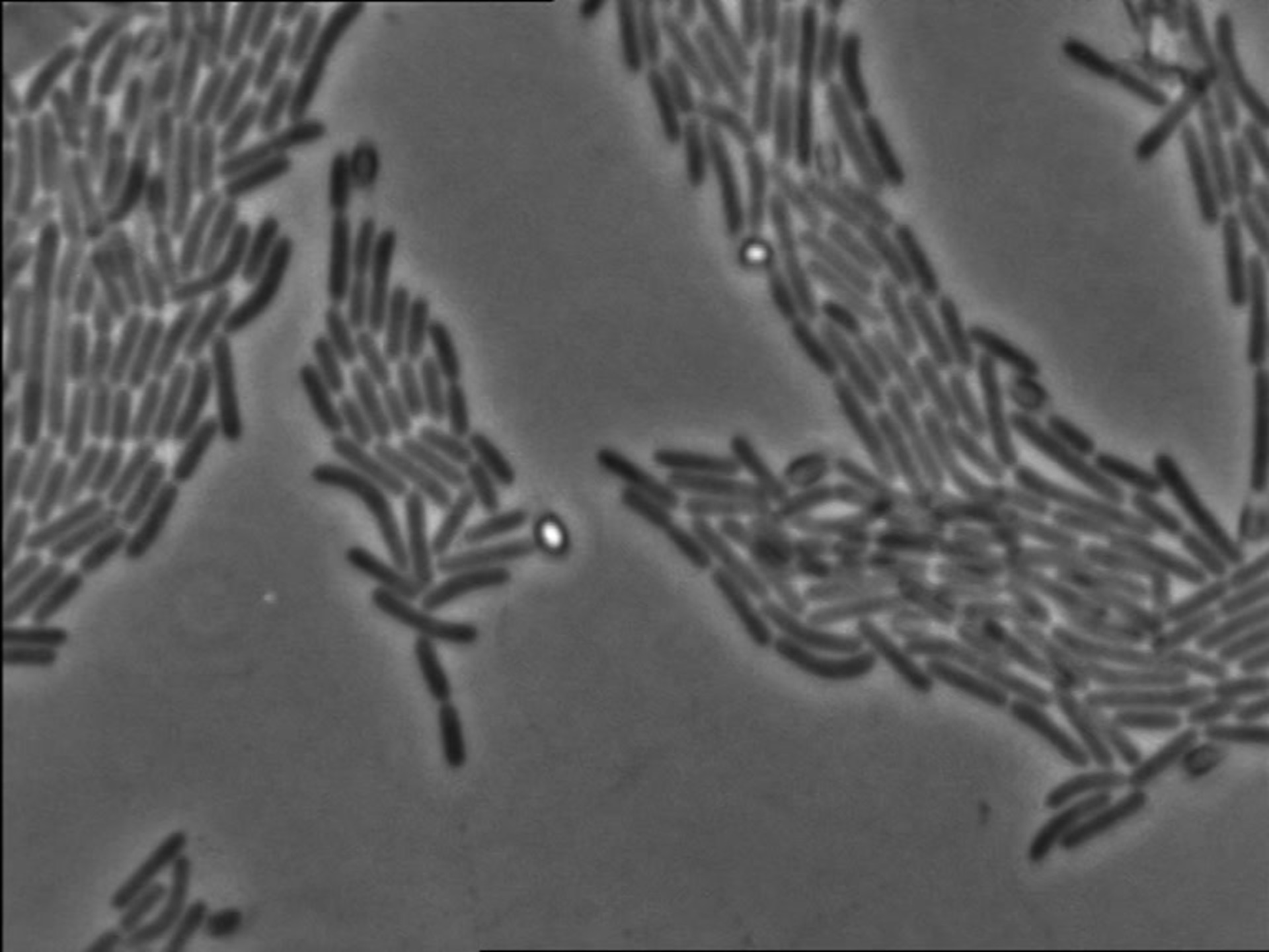 clostridium tetani electron micrograph